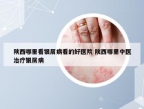 陕西哪里看银屑病看的好医院 陕西哪里中医治疗银屑病