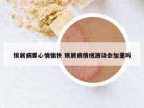 银屑病要心情愉快 银屑病情绪激动会加重吗
