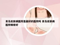 青岛皮肤病医院是最好的医院吗 青岛皮肤病医院哪些好