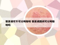 银屑病可不可以喝咖啡 银屑病期间可以喝咖啡吗