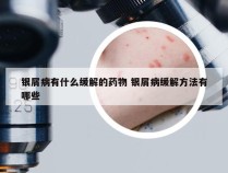 银屑病有什么缓解的药物 银屑病缓解方法有哪些
