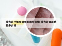 激光治疗银屑病哪家医院能做 激光治银屑病要多少钱