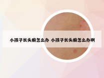 小孩子长头癣怎么办 小孩子长头癣怎么办啊