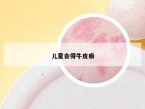 儿童会得牛皮癣