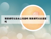 银屑病可以去水上乐园吗 银屑病可以去澡堂吗