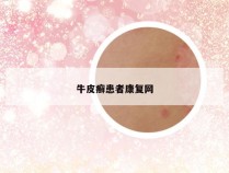 牛皮癣患者康复网