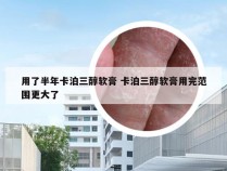 用了半年卡泊三醇软膏 卡泊三醇软膏用完范围更大了