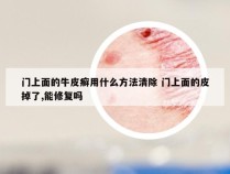 门上面的牛皮癣用什么方法清除 门上面的皮掉了,能修复吗