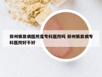 郑州银屑病医院是专科医院吗 郑州银屑病专科医院好不好