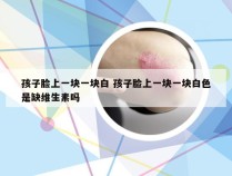 孩子脸上一块一块白 孩子脸上一块一块白色是缺维生素吗
