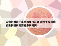 生物制剂治牛皮癣需要打几针 治疗牛皮肤癣的生物制剂需要打多长时间