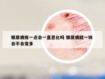 银屑病有一点会一直恶化吗 银屑病就一块 会不会变多