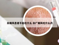 白癜风患者不能吃什么 白疒癜风吃什么药