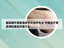 最新国外银屑病关节炎治疗方法 外国治疗银屑病的最佳药是什么