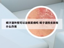 蝎子酒外擦可以治银屑病吗 蝎子酒擦皮肤有什么作用