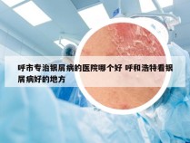呼市专治银屑病的医院哪个好 呼和浩特看银屑病好的地方
