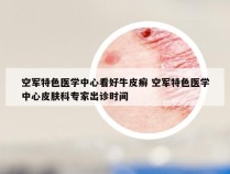 空军特色医学中心看好牛皮癣 空军特色医学中心皮肤科专家出诊时间