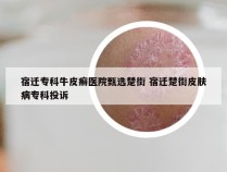 宿迁专科牛皮癣医院甄选楚街 宿迁楚街皮肤病专科投诉