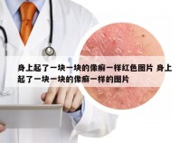 身上起了一块一块的像癣一样红色图片 身上起了一块一块的像癣一样的图片