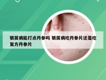 银屑病能打点丹参吗 银屑病吃丹参片还是吃复方丹参片