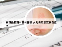 白斑最初期一般长在哪 女儿白斑靠饮食自愈了