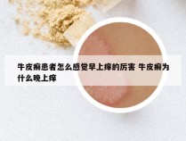 牛皮癣患者怎么感觉早上痒的厉害 牛皮癣为什么晚上痒