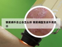 银屑病不忌口会怎么样 银屑病医生说不用忌口