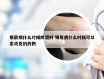 银屑病什么时候除湿好 银屑病什么时候可以出攻克的药物