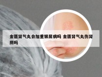 金匮肾气丸会加重银屑病吗 金匮肾气丸伤肾阴吗