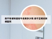 南宁有谁知道祛牛皮癣多少钱 南宁正规皮肤病医院