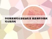 孕妇银屑病可以涂硅油乳膏 银屑病怀孕期间可以擦药吗