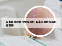 石家庄医院排行榜皮肤科 石家庄医院皮肤科哪家好