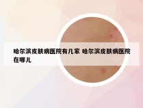 哈尔滨皮肤病医院有几家 哈尔滨皮肤病医院在哪儿