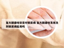 复方酮康唑软膏对银屑病 复方酮康唑发用洗剂银屑病能用吗