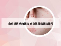 南京银屑病的医院 南京银屑病医院挂号