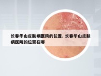 长春华山皮肤病医院的位置. 长春华山皮肤病医院的位置在哪