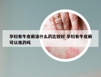 孕妇有牛皮癣涂什么药比较好 孕妇有牛皮癣可以用药吗