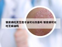 银屑病吃灵芝孢子油可以改善吗 银屑病可以吃芝麻油吗