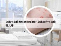 上海牛皮癣专科医院哪里好 上海治疗牛皮癣哪儿好