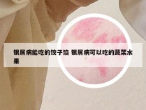 银屑病能吃的饺子馅 银屑病可以吃的蔬菜水果