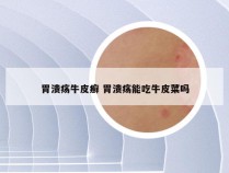 胃溃疡牛皮癣 胃溃疡能吃牛皮菜吗