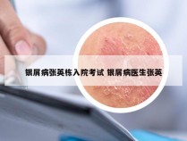 银屑病张英栋入院考试 银屑病医生张英