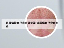 银屑病能自己自愈又复发 银屑病自己会自愈吗