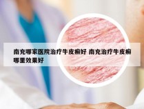 南充哪家医院治疗牛皮癣好 南充治疗牛皮癣哪里效果好