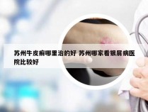 苏州牛皮癣哪里治的好 苏州哪家看银屑病医院比较好