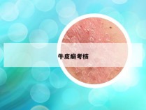 牛皮癣考核