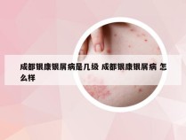 成都银康银屑病是几级 成都银康银屑病 怎么样