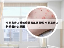 小朋友身上爱长癣是怎么回事呢 小朋友身上长癣是什么原因