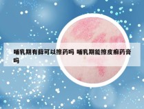 哺乳期有藓可以擦药吗 哺乳期能擦皮癣药膏吗