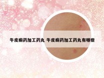 牛皮癣药加工药丸 牛皮癣药加工药丸有哪些